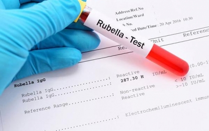Quy trình thực hiện xét nghiệm Rubella đối với thai phụ