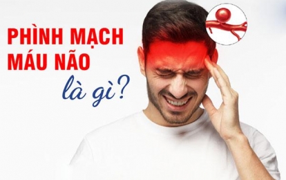 Nguyên nhân và triệu chứng nhận diện bệnh phình mạch máu não