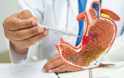 GIST dạ dày và những yếu tố nguy cơ cần lưu ý