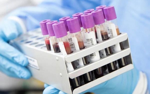 Xét nghiệm máu: Công cụ quan trọng trong phát hiện sớm ung thư