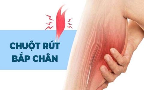 Nguyên nhân và biện pháp khắc phục chuột rút bắp chân