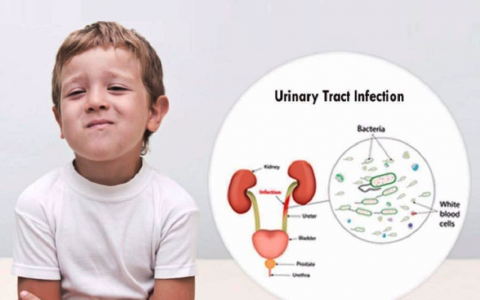 Dấu hiệu nhiễm khuẩn tiết niệu ở trẻ em và cách xử lý đúng cách