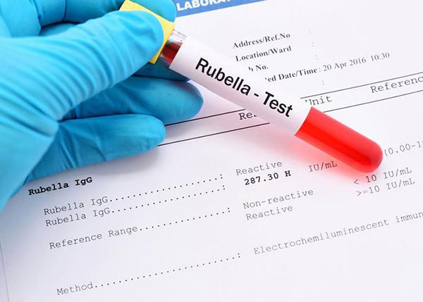 Quy trình thực hiện xét nghiệm Rubella đối với thai phụ