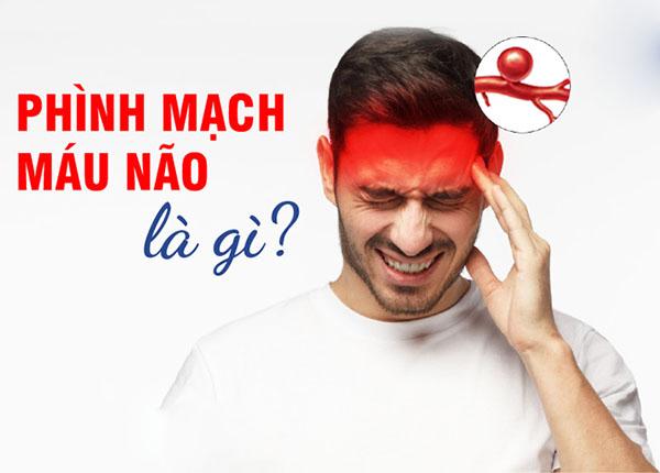 phình mạch máu não