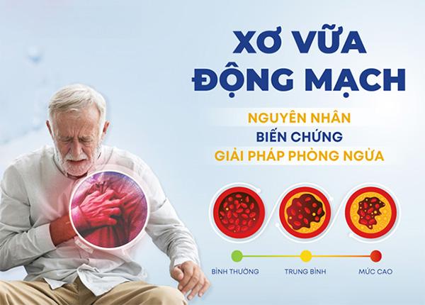 Nguyên nhân và phương pháp chẩn đoán xơ vữa động mạch