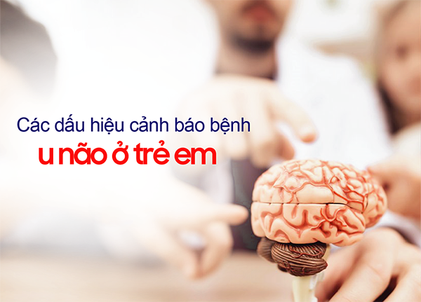 Những dấu hiệu nhận diện bệnh u não ở trẻ em