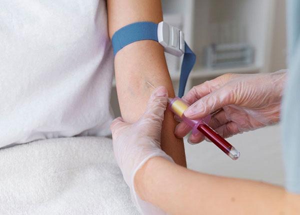 Tĩnh mạch và những bệnh lý phổ biến cần phòng tránh