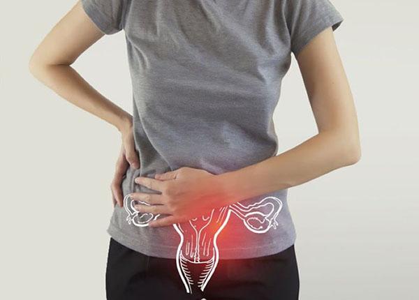 U xơ tử cung lành tính có cần điều trị hay không